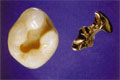 Goldinlday
